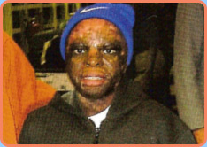 david, psycho-neuro-Kinesiologie